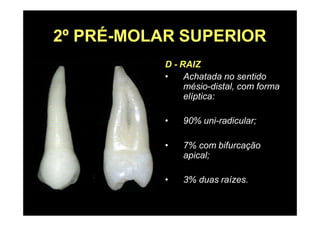 2º PRÉ-MOLAR SUPERIOR
D - RAIZ
• Achatada no sentido
mésio-distal, com forma
elíptica:
• 90% uni-radicular;
• 7% com bifurcação
apical;
• 3% duas raízes.
 