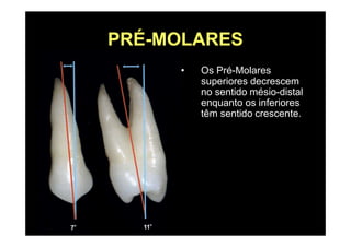 PRÉ-MOLARES
• Os Pré-Molares
superiores decrescem
no sentido mésio-distal
enquanto os inferiores
têm sentido crescente.
 
