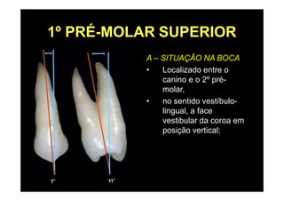 1º PRÉ-MOLAR SUPERIOR
A – SITUAÇÃO NA BOCA
• Localizado entre o
canino e o 2º pré-
molar,
• no sentido vestíbulo-
lingual, a face
vestibular da coroa em
posição vertical;
 