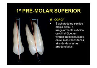 1º PRÉ-MOLAR SUPERIOR
B - COROA
• É achatada no sentido
mésio-distal, e
irregularmente cuboidal
ou cilindróide, em
virtude da continuidade
entre suas várias faces,
através de arestas
arredondadas;
 
