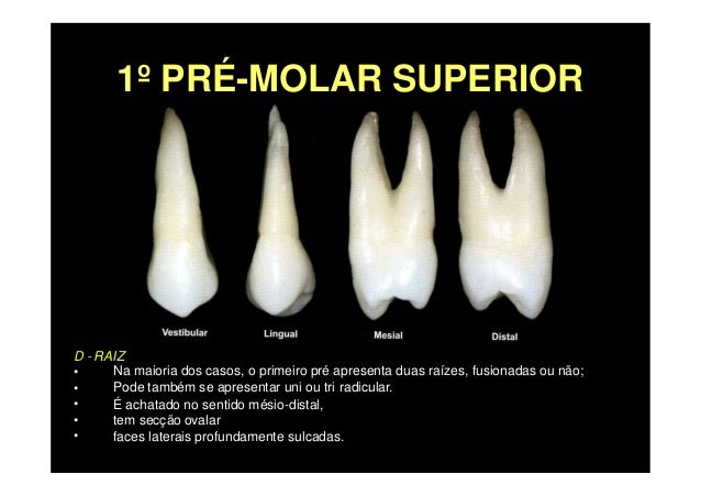 Premolares Superiores