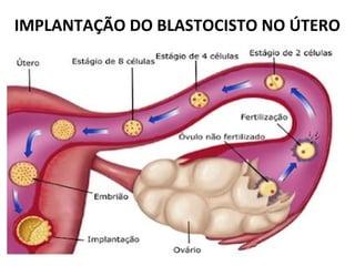 IMPLANTAÇÃO DO BLASTOCISTO NO ÚTERO
 