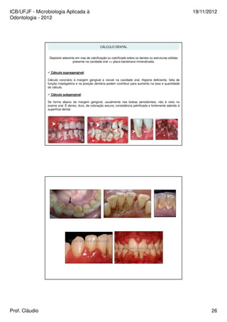 ICB/UFJF - Microbiologia Aplicada à 
Odontologia - 2012 
19/11/2012 
CÁLCULO DENTAL 
Depósito aderente em vias de calcificação ou calcificado sobre os dentes ou estruturas sólidas 
presente na cavidade oral = placa bacteriana mineralizada. 
 Cálculo supragengival: 
Cálculo coronário à margem gengival e visível na cavidade oral. Higiene deficiente, falta de 
função mastigatória e na posição dentária podem contribuir para aumento na taxa e quantidade 
do cálculo. 
 Cálculo subgengival: 
Se forma abaixo da margem gengival, usualmente nas bolsas periodontais, não é visto no 
exame oral. É denso, duro, de coloração escura, consistência petrificada e fortemente aderido à 
superfície dental. 
Prof. Cláudio 26 
 