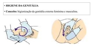 • HIGIENE DA GENITÁLIA
• Conceito: higienização da genitália externa feminina e masculina.
 
