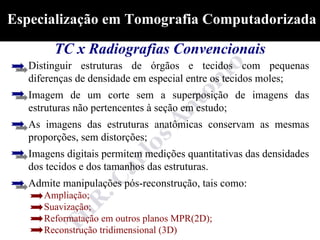 Especialização em Tomografia Computadorizada

        TC x Radiografias Convencionais
   Distinguir estruturas de órgãos e tecidos com pequenas
   diferenças de densidade em especial entre os tecidos moles;
   Imagem de um corte sem a superposição de imagens das
   estruturas não pertencentes à seção em estudo;
   As imagens das estruturas anatômicas conservam as mesmas
   proporções, sem distorções;
   Imagens digitais permitem medições quantitativas das densidades
   dos tecidos e dos tamanhos das estruturas.
   Admite manipulações pós-reconstrução, tais como:
      Ampliação;
      Suavização;
      Reformatação em outros planos MPR(2D);
      Reconstrução tridimensional (3D)
 