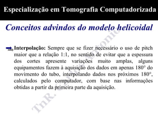 Especialização em Tomografia Computadorizada

Conceitos advindos do modelo helicoidal

   Interpolação: Sempre que se fizer necessário o uso de pitch
   maior que a relação 1:1, no sentido de evitar que a espessura
   dos cortes apresente variações muito amplas, alguns
   equipamentos fazem à aquisição dos dados em apenas 180° do
   movimento do tubo, interpolando dados nos próximos 180°,
   calculados pelo computador, com base nas informações
   obtidas a partir da primeira parte da aquisição.
 
