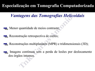 Especialização em Tomografia Computadorizada

    Vantagens das Tomografias Helicoidais

   Menor quantidade de meios contraste;

   Reconstrução retrospectiva de cortes;

   Reconstruções multiplanares (MPR) e tridimensionais (3D);

    Imagens contínuas sem a perda de lesões por deslocamento
   dos órgãos internos.
 