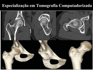 Especialização em Tomografia Computadorizada
 