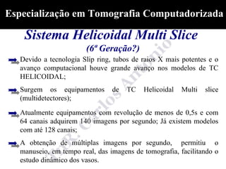 Especialização em Tomografia Computadorizada

    Sistema Helicoidal Multi Slice
                        (6ª Geração?)
   Devido a tecnologia Slip ring, tubos de raios X mais potentes e o
   avanço computacional houve grande avanço nos modelos de TC
   HELICOIDAL;
   Surgem os equipamentos        de   TC   Helicoidal   Multi   slice
   (multidetectores);

   Atualmente equipamentos com revolução de menos de 0,5s e com
   64 canais adquirem 140 imagens por segundo; Já existem modelos
   com até 128 canais;
   A obtenção de múltiplas imagens por segundo, permitiu o
   manuseio, em tempo real, das imagens de tomografia, facilitando o
   estudo dinâmico dos vasos.
 