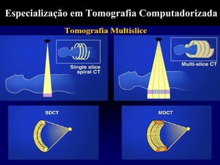 Especialização em Tomografia Computadorizada
 