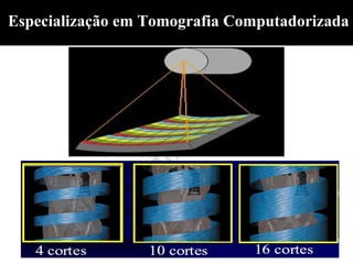 Especialização em Tomografia Computadorizada
 