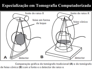 Especialização em Tomografia Computadorizada
 