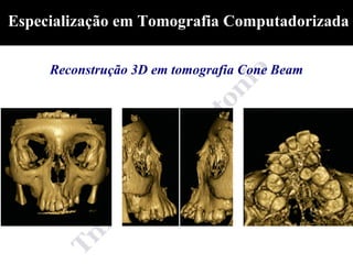 Especialização em Tomografia Computadorizada

     Reconstrução 3D em tomografia Cone Beam
 