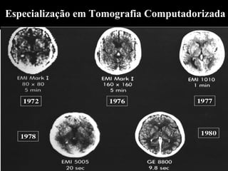 Especialização em Tomografia Computadorizada
 