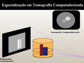 Especialização em Tomografia Computadorizada
 
