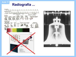 Aula 11
          Radiografia ...
 