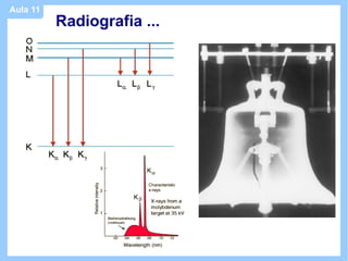 Aula 11
          Radiografia ...
 