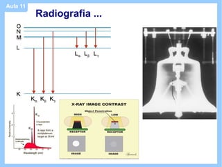 Aula 11
          Radiografia ...
 
