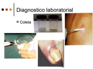Diagnostico laboratorial
 Coleta
 