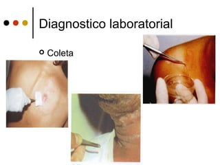 Diagnostico laboratorial
 Coleta
 
