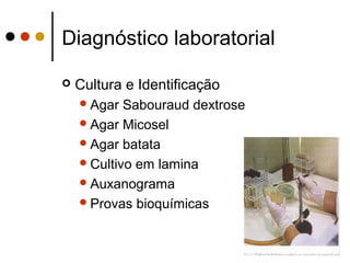 Diagnóstico laboratorial
 Cultura e Identificação
Agar Sabouraud dextrose
Agar Micosel
Agar batata
Cultivo em lamina
Auxanograma
Provas bioquímicas
 