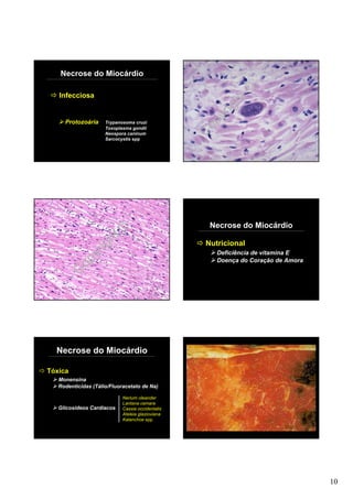 Necrose do Miocárdio

   Infecciosa
                                                           ht©
                                                         ig
                                                      yr
     Protozoária     Trypanosoma cruzi
                     Toxoplasma gondii
                     Neospora caninum             C op
                     Sarcocystis spp




                                                   Necrose do Miocárdio
                   ht©
                 ig                               Nutricional
              yr                                     Deficiência de vitamina E


          C op                                       Doença do Coração de Amora




  Necrose do Miocárdio

Tóxica
   Monensina
   Rodenticidas (Tálio/Fluoracetato de Na)

                            Nerium oleander
                            Lantana camara
   Glicosídeos Cardíacos    Cassia occidentalis
                            Ateleia glazioviana
                            Kalanchoe spp




                                                                                  10
 