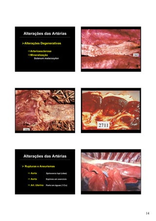 Alterações das Artérias

Alterações Degenerativas

   Arterioesclerose
   Mineralização
       Solanum malacoxylon




Alterações das Artérias

Rupturas e Aneurismas

    Aorta          Spirocerca lupi (cães)

    Aorta          Eqüinos em exercício


    Art. Uterina   Parto em éguas ( Cu)




                                            14
 