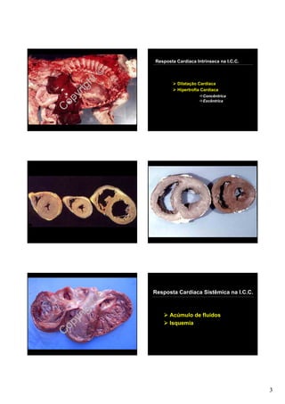 Resposta Cardíaca Intrínseca na I.C.C.



         ht©
       ig
                         Dilatação Cardíaca

    yr
                         Hipertrofia Cardíaca


  op
                                     Concêntrica
                                     Excêntrica

C




               Resposta Cardíaca Sistêmica na I.C.C.

         ht©
       ig
    yr               Acúmulo de fluidos


C op                 Isquemia




                                                        3
 