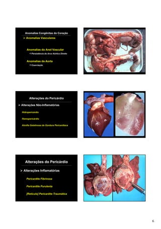 Anomalias Congênitas do Coração
   Anomalias Vasculares



    Anomalias do Anel Vascular
        Persistência do Arco Aórtico Direito


    Anomalias da Aorta
        Coarctação




      Alterações do Pericárdio

Alterações Não-Inflamatórias

Hidropericárdio

Hemopericárdio

Atrofia Gelatinosa da Gordura Pericardíaca




   Alterações do Pericárdio

 Alterações Inflamatórias
                                                        ht©
                                                      ig
    Pericardite Fibrinosa
                                                   yr
    Pericardite Purulenta
                                               C op
    [Retículo] Pericardite Traumática




                                                              6
 