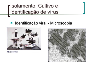 Isolamento, Cultivo e
Identificação de vírus
 Identificação viral - Microscopia
 