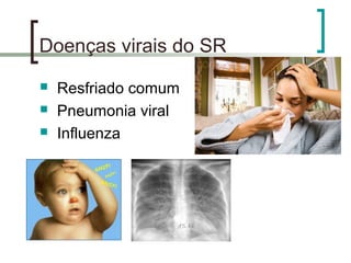 Doenças virais do SR
 Resfriado comum
 Pneumonia viral
 Influenza
 