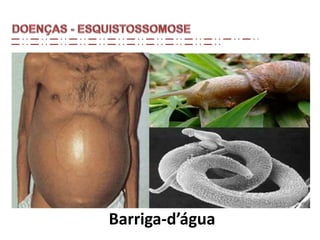 Barriga-d’água
 