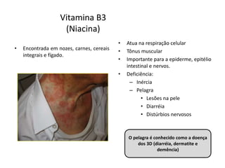Vitamina B3
(Niacina)
• Encontrada em nozes, carnes, cereais
integrais e fígado.
• Atua na respiração celular
• Tônus muscular
• Importante para a epiderme, epitélio
intestinal e nervos.
• Deficiência:
– Inércia
– Pelagra
• Lesões na pele
• Diarréia
• Distúrbios nervosos
O pelagra é conhecido como a doença
dos 3D (diarréia, dermatite e
demência)
 