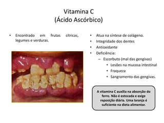 Vitamina C
(Ácido Ascórbico)
• Encontrado em frutas cítricas,
legumes e verduras.
• Atua na síntese de colágeno.
• Integridade dos dentes
• Antioxidante
• Deficiência:
– Escorbuto (mal das gengivas)
• Lesões na mucosa intestinal
• Fraqueza
• Sangramento das gengivas.
A vitamina C auxilia na absorção do
ferro. Não é estocada e exige
reposição diária. Uma laranja é
suficiente na dieta alimentar.
 