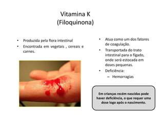Vitamina K
(Filoquinona)
• Produzida pela flora intestinal
• Encontrada em vegetais , cereais e
carnes.
• Atua como um dos fatores
de coagulação.
• Transportada do trato
intestinal para o fígado,
onde será estocada em
doses pequenas.
• Deficiência:
– Hemorragias
Em crianças recém nascidas pode
haver deficiência, o que requer uma
dose logo após o nascimento.
 