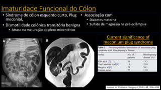 Imaturidade Funcional do Cólon
• Síndrome do cólon esquerdo curto, Plug
meconial,
• Dismotilidade colônica transitória benigna
• Atraso na maturação do plexo mioentérico
• Associação com
• Diabetes materna
• Sulfato de magnésio na pré-eclâmpsia
Current significance of
meconium plug syndrome
 