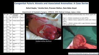 Epidermólise Bullosa
 