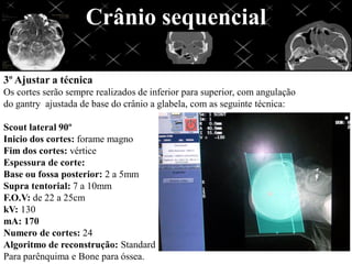 Crânio sequencial

3º Ajustar a técnica
Os cortes serão sempre realizados de inferior para superior, com angulação
do gantry ajustada de base do crânio a glabela, com as seguinte técnica:

Scout lateral 90º
Inicio dos cortes: forame magno
Fim dos cortes: vértice
Espessura de corte:
Base ou fossa posterior: 2 a 5mm
Supra tentorial: 7 a 10mm
F.O.V: de 22 a 25cm
kV: 130
mA: 170
Numero de cortes: 24
Algoritmo de reconstrução: Standard
Para parênquima e Bone para óssea.
 