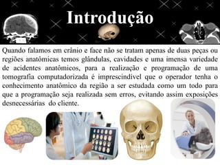 Introdução
Quando falamos em crânio e face não se tratam apenas de duas peças ou
regiões anatômicas temos glândulas, cavidades e uma imensa variedade
de acidentes anatômicos, para a realização e programação de uma
tomografia computadorizada é imprescindível que o operador tenha o
conhecimento anatômico da região a ser estudada como um todo para
que a programação seja realizada sem erros, evitando assim exposições
desnecessárias do cliente.
 