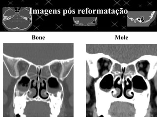 Imagens pós reformatação

Bone                Mole
 