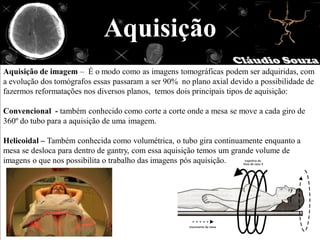 Aquisição
Aquisição de imagem – É o modo como as imagens tomográficas podem ser adquiridas, com
a evolução dos tomógrafos essas passaram a ser 90% no plano axial devido a possibilidade de
fazermos reformatações nos diversos planos, temos dois principais tipos de aquisição:

Convencional - também conhecido como corte a corte onde a mesa se move a cada giro de
360º do tubo para a aquisição de uma imagem.

Helicoidal – Também conhecida como volumétrica, o tubo gira continuamente enquanto a
mesa se desloca para dentro de gantry, com essa aquisição temos um grande volume de
imagens o que nos possibilita o trabalho das imagens pós aquisição.
 