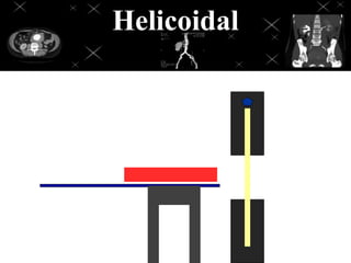 Helicoidal
 