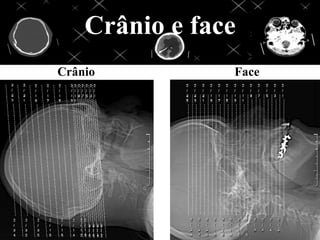 Crânio e face
Crânio          Face
 