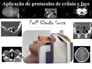 Profº Claudio Souza
Aplicação de protocolos de crânio e face
 