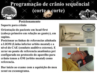 Programação de crânio sequêncial
(corte a corte)
Posicionamento
Suporte para crânio
Orientação do paciente em head first
(cabeça primeiro em relação ao gantry), em
supino.
Posicionar as linhas de referencias alinhada
a LIOM (Linha inferior orbito meatal) e a
nível do CAE (conduto auditivo externo). E
zerar no ponto de referencia anatômica pré
configurado no protocolo do aparelho para
crânio temos a OM (orbito meatal) como
referencia.
Dar início ao exame com a aquisição do meu
scout ou escanograma.
 