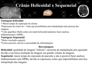 Crânio Helicoidal x Sequencial
Vantagens helicoidal
* Menor tempo de exposição do cliente.
*Espessuras de cortes de < 1mm que possibilitam uma interpolação mais precisa das
imagens.
* Com aparelhos Multi-cortes em modo helicoidal podemos fazer analises
tridimensionais e MPRs.
Vantagens Sequencial
*Maior resolução espacial.
*Cortes precisos, não há a necessidade de reformatações.
Desvantagens
Helicoidal- qualidade de imagem “inferior”, necessita de manipulação pós aquisição
devido a sua baixa resolução de imagem seu grande volume de imagens.
Sequêncial- maior tempo de exposição do paciente e não é possível fazer analises
tridimensionais nem MPRs, devido as espessuras cortes que impossibilitam uma boa
interpolação das imagens.
 