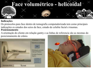 Face volumétrico - helicoidal
Indicações
Os protocolos para face dentro de tomografia computadorizada tem como principais
indicações os estudos dos seios da face, estudo de celulite facial e traumas.
Posicionamento
A orientação do cliente em relação gantry e as linhas de referencia são as mesmas do
posicionamento de crânio.
 