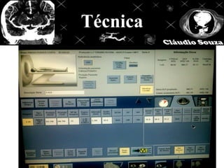 Técnica
 