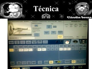 Técnica
 