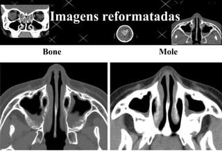 Imagens reformatadas
Bone Mole
 